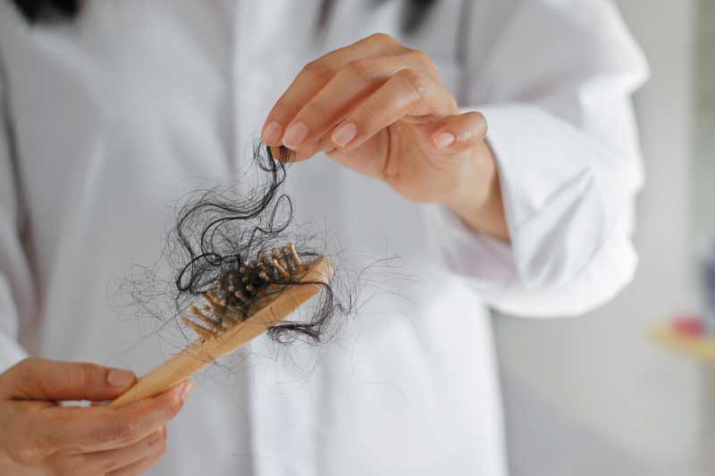 حجامت در درمان ریزش مو